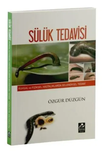 Sülük Tedavisi; Ruhsal ve Fiziksel Hastalıklarda Geleneksel Tedavi