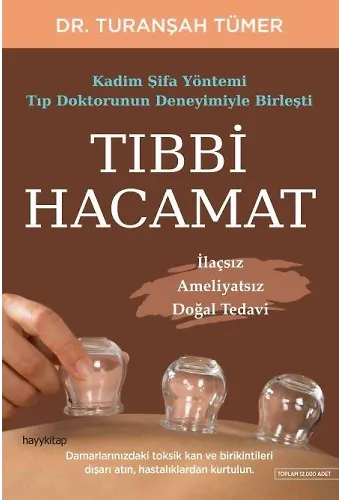 Tıbbi Hacamat